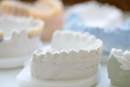 قوالب أسنان لتركيبات الأسنان في عيادة DC Lieporiai