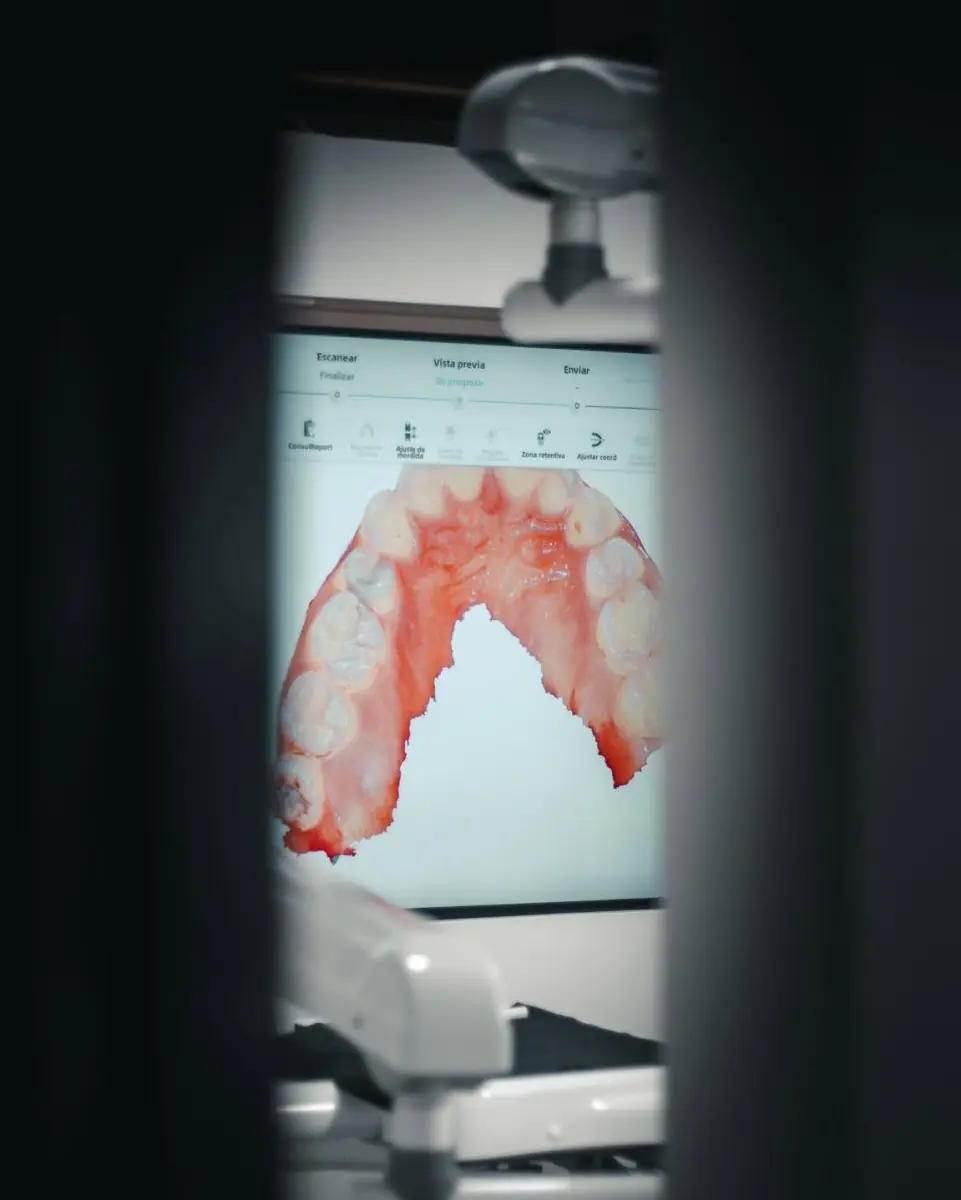 Digital dental scan displayed on monitor at Unik Specialized Dentistry clinic