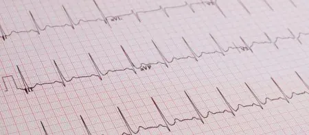 تخطيط القلب في مستشفى Private Medline Adana، تشخيص القلب في تركيا
