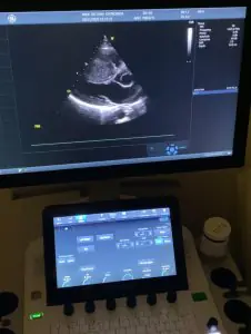 جهاز الموجات فوق الصوتية وفحص القلب في مستشفى Private Medline Adana، تركيا