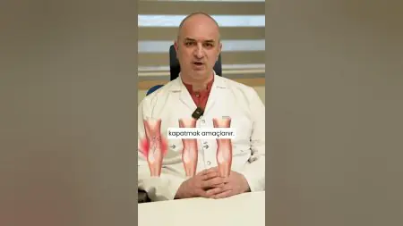 طبيب في Özel Medline Adana Hastanesi يشرح خيارات علاج الدوالي
