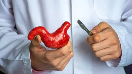 طبيب يحمل نموذج معدة ومشرط في عيادة South Florida Bariatrics