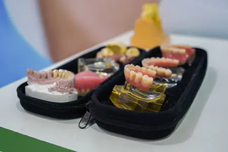 Modelos de prótesis dentales en la clínica Oral 360, equipo dental moderno