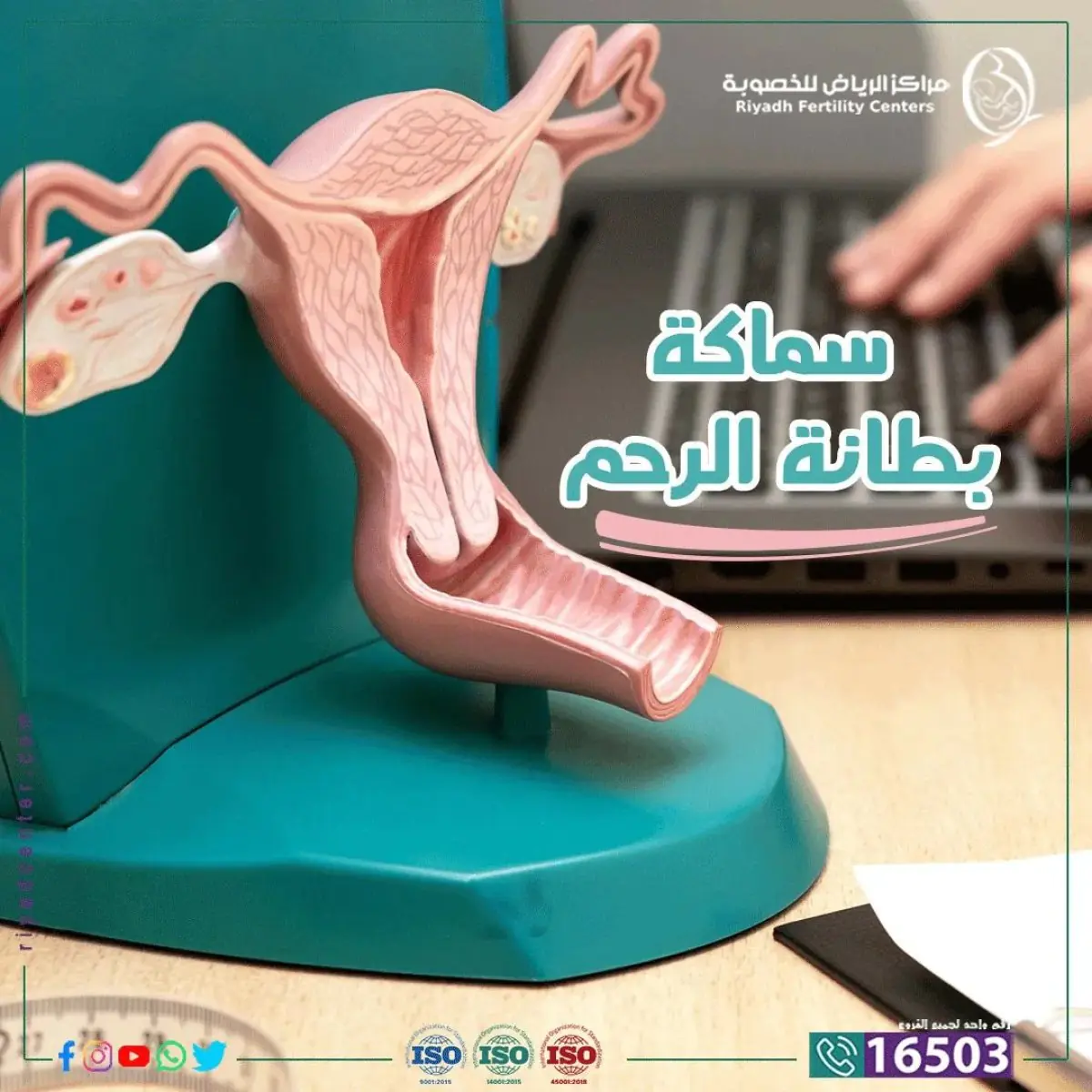 Uterus anatomical model at Riyadh Fertility Center for gynecology consultation