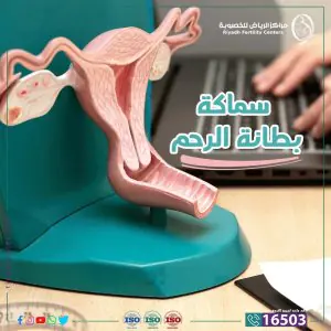 Modelo anatómico de útero en Riyadh Fertility Center para consulta ginecológica