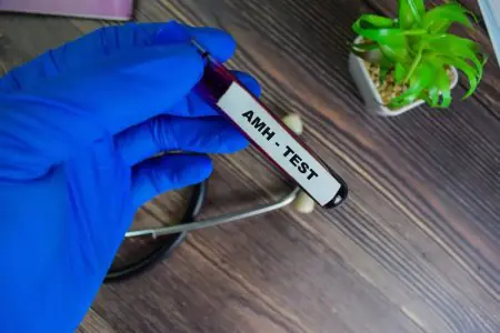 Muestra de sangre para prueba AMH en el laboratorio de Riyadh Fertility Center