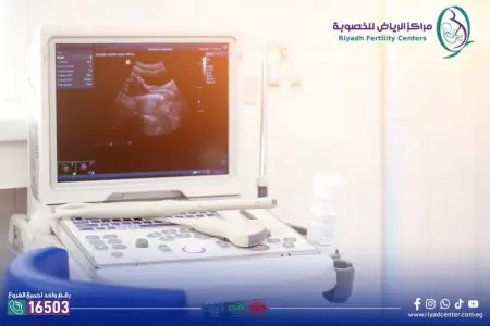 Máquina de ultrasonido en Riyadh Fertility Center para diagnóstico de salud reproductiva
