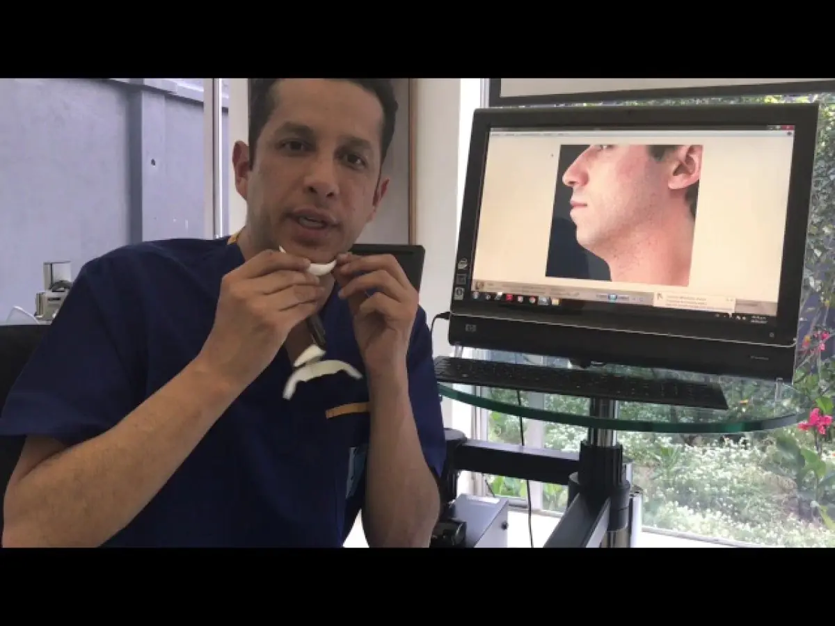Consultation room at Ivan Santos Plastic Surgery with doctor explaining chin implant