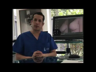 Sala de consulta en Ivan Santos Plastic Surgery con médico e imágenes de cirugía mamaria
