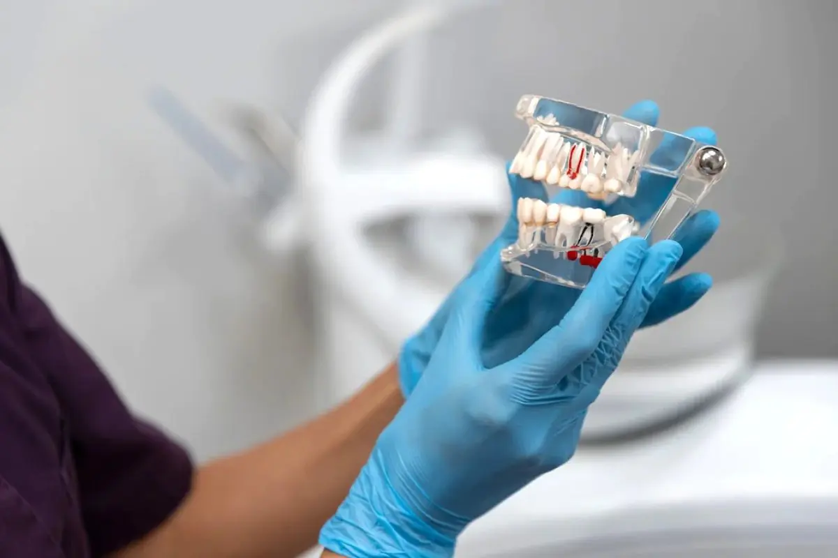 Dental model for treatment planning at VYT Dental Studio