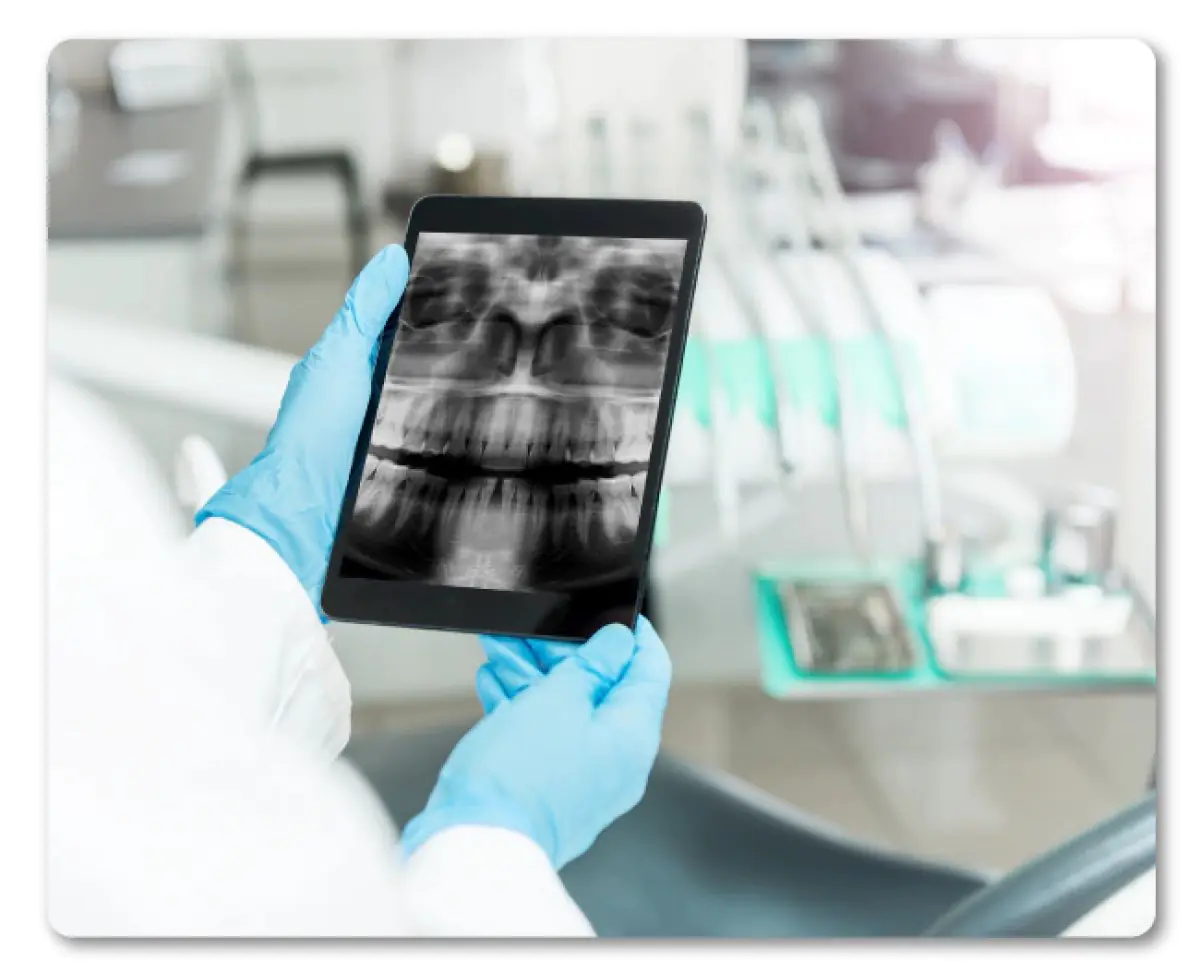 Digital dental X-ray on tablet at DentiSalud clinic, modern dental equipment visible
