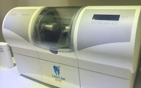 Máquina fresadora dental CAD/CAM en la clínica Dental Global