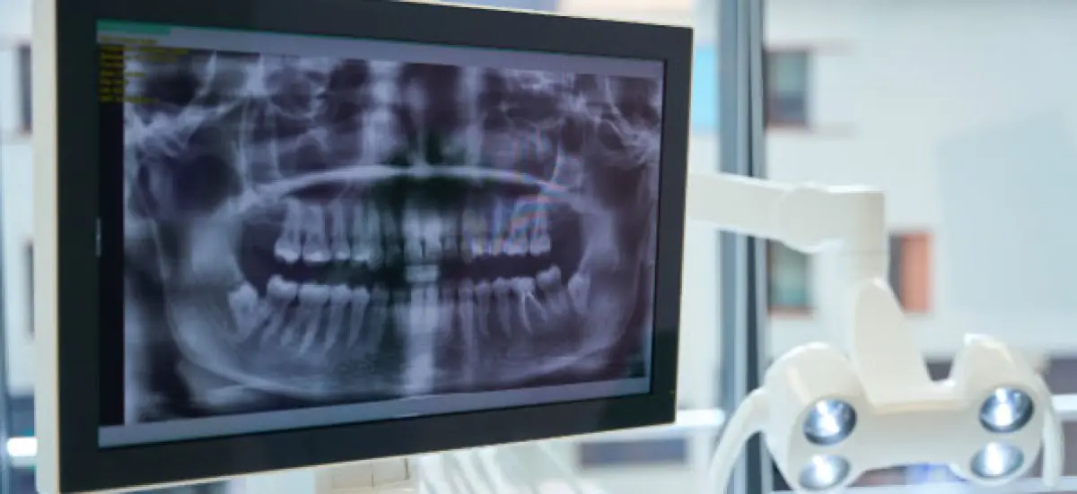 Dental X-ray imaging equipment at Dental Dr. Sugeiry Morel clinic