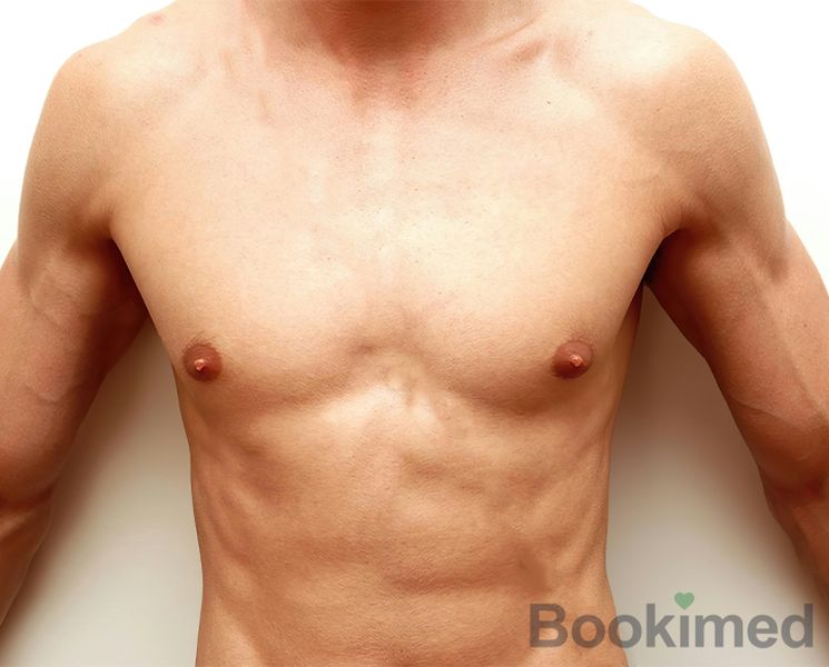 airsculpt-gynecomastia-surgery