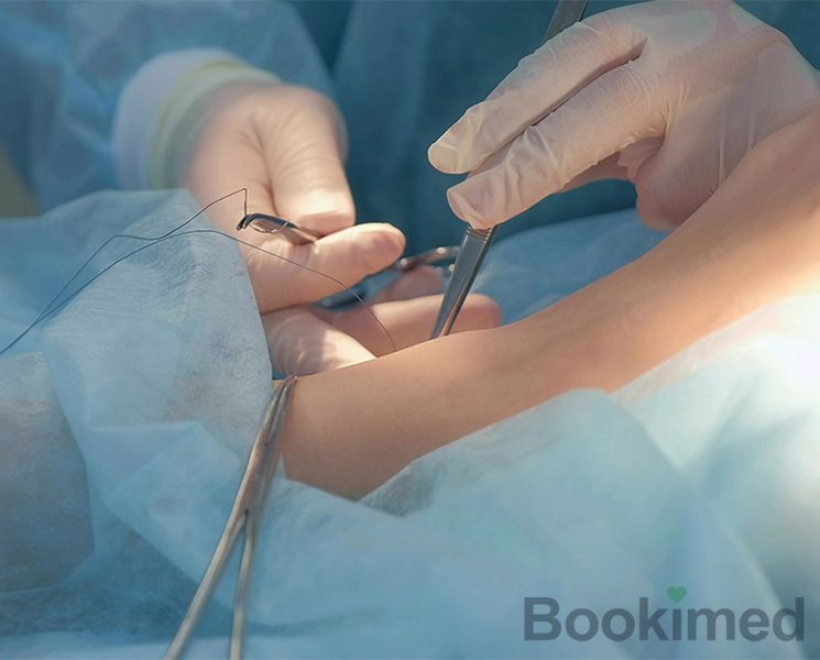 arthrodesis-of-the-ankle-joint