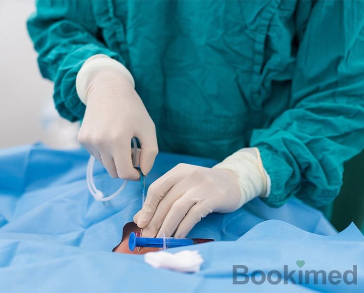 carotid-angioplasty-and-stenting