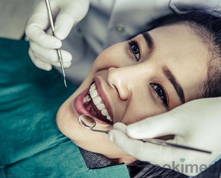 emax-veneers