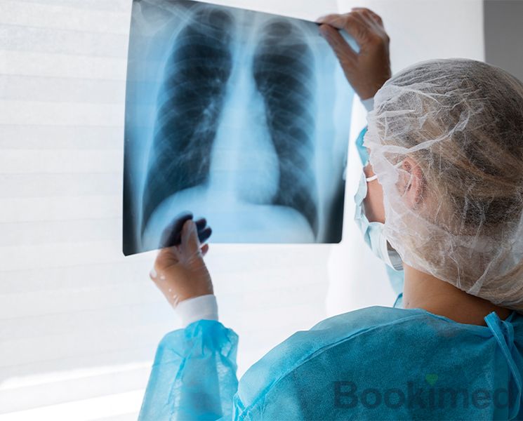 lobectomy