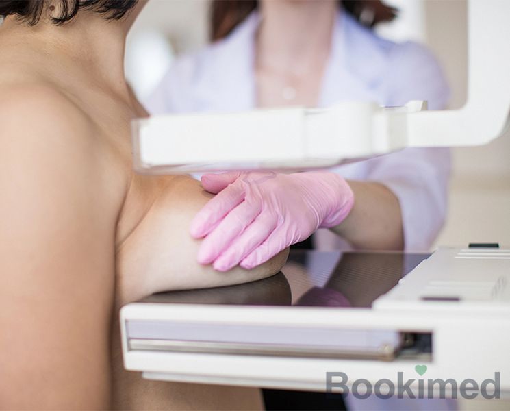 mastectomy
