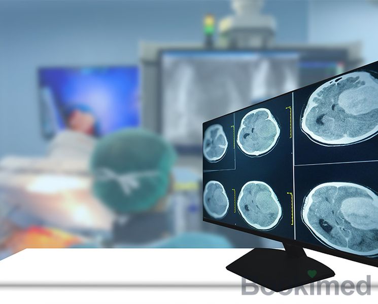 resection-of-glioblastoma