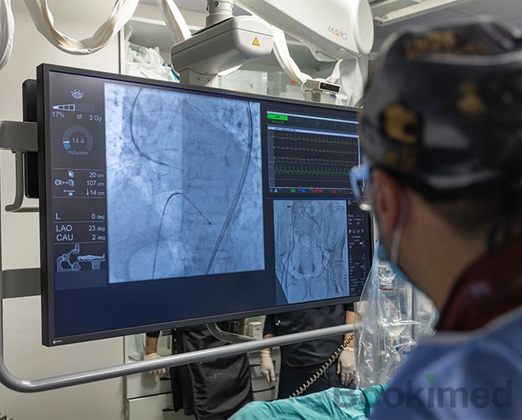 transluminal-arterial-angioplasty-pta-and-stenting