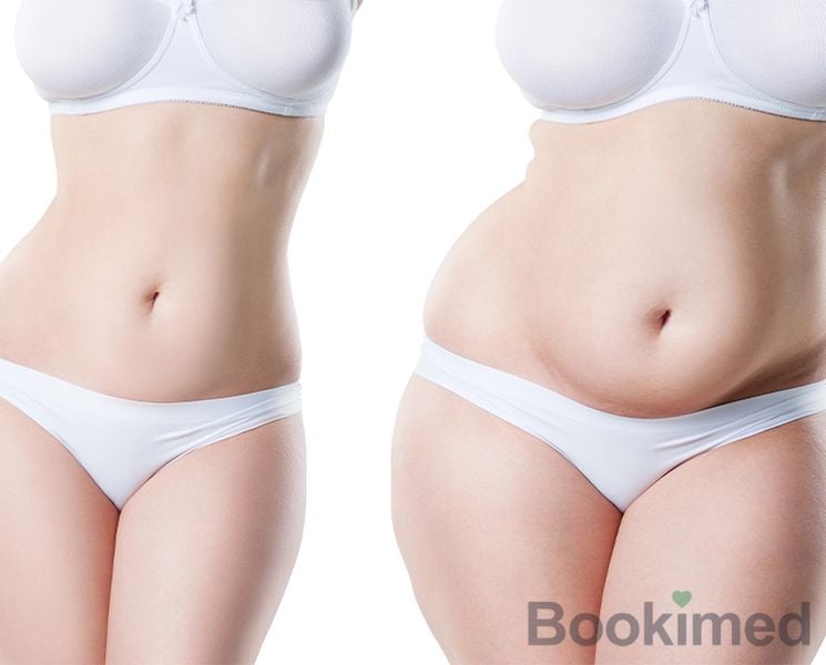 vaser-liposuction