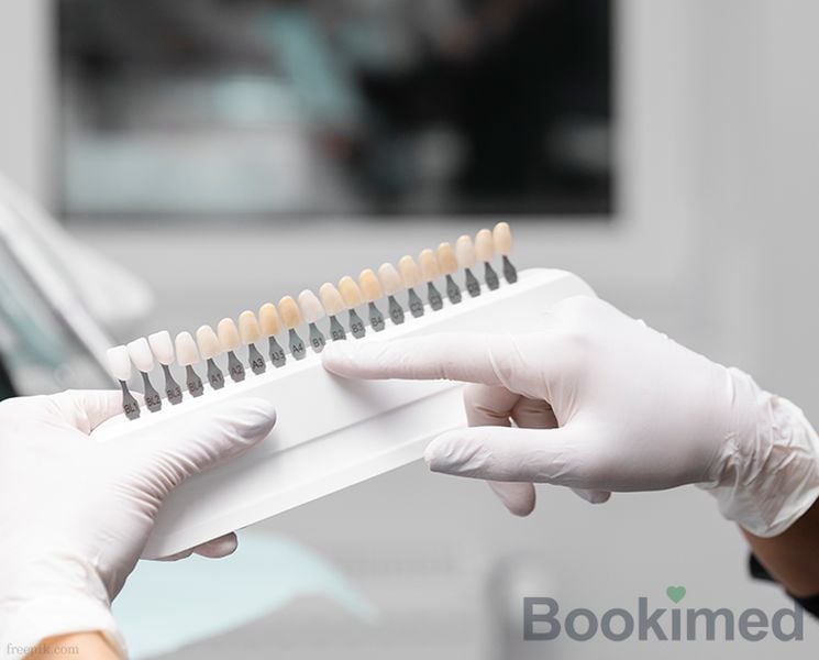 zirconia-veneers