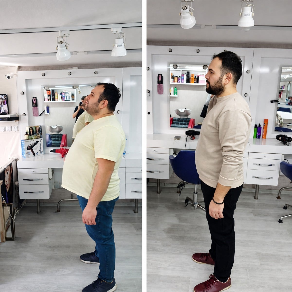 Resultados antes y después de manga gástrica en Associate Professor M. Derda Ozer DERDA SAGLIK HIZMETLERI