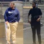 Efekty przed i po operacji rękawowej resekcji żołądka w Memorial Ankara Hospital, widoczna utrata wagi