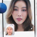 Mini facelift before and after result at Dr. Chen Surgery Hospital International Center, facial rejuvenation