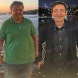 Vorher-nachher-Ergebnis Magenballon bei Memorial Antalya Hospital – sichtbarer Gewichtsverlust