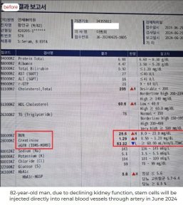 Kidney function test results before stem cell rejuvenation at RE:YOUTH (YONSEI BH Arterial Stemcell Clinic)