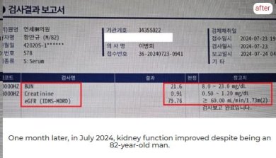 Improved kidney function after stem cell therapy at RE:YOUTH (YONSEI BH Arterial Stemcell Clinic) result