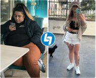 Vorher-nachher-Ergebnisse der Magenresektion im Lokman Hekim Istanbul Hospital, sichtbarer Gewichtsverlust