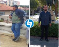 Vorher-nachher-Ergebnis der Magenresektion in Lokman Hekim Istanbul Hospital, sichtbarer Gewichtsverlust