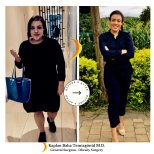 نتائج قبل وبعد جراحة تحويل مسار المعدة في Lotus Bariatrics Clinic – فقدان وزن ملحوظ