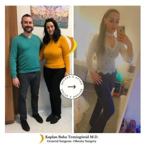 Gastric bypass before and after results at Lotus Bariatrics Clinic – visible weight loss success