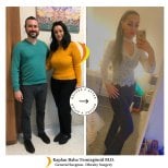 Gastric bypass before and after results at Lotus Bariatrics Clinic – visible weight loss success