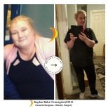 Результати до і після шлункового шунтування в Lotus Bariatrics Clinic – значна втрата ваги