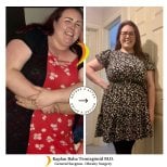 Результати до і після шунтування шлунка в Lotus Bariatrics Clinic – значна втрата ваги