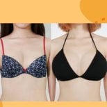 Before and after breast augmentation results at ID Clinic Bangkok, enhanced breast volume