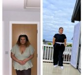 Результати до і після Roux-en-Y шунтування в клініці доктора Іслама Абдельхалека, схуднення