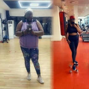 Результати до і після Roux-en-Y шунтування у клініці доктора Іслама Абдельхалека