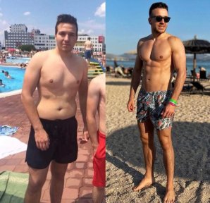 Before and after abdominal etching results at Dr. Safa Manav Clinic, defined six pack abs