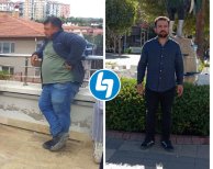 Vorher-nachher-Ergebnis der endoskopischen Schlauchmagen-OP in Lokman Hekim Istanbul Hospital