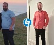Before and after gastric sleeve surgery results at Lokman Hekim Istanbul Hospital, weight loss