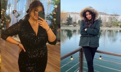 Avant et après sleeve gastrectomie à ÜMRAN TIP MERKEZİ – perte de poids visible