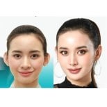Before and after otoplasty results at Wansiri Hospital, ear reshaping for natural look