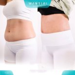 Before and after liposuction results at Wansiri Hospital, visible abdominal contour improvement