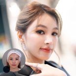 Mini facelift before and after results at Dr. Chen Surgery Hospital International Center